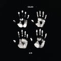 Kaleo - (PRESALE 6/19/26) A/B (IEX BLACK AND WHITE 2xVINYL) | Mint (M) Mint (M)